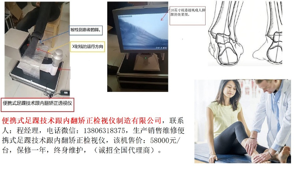 便攜式足踝技術跟內翻矯正檢視儀