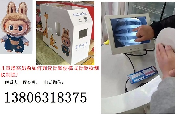 寶寶脾胃調理兒童成長奶粉如何判讀骨齡便攜式骨齡檢測儀